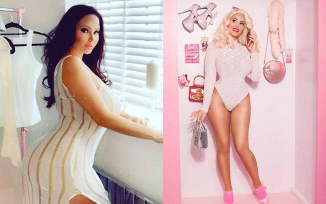 Star Delgiudice já gastou mais de R$1 milhão em plásticas para ficar 'perfeita' e, agora, quer ter a 'vagina da Barbie