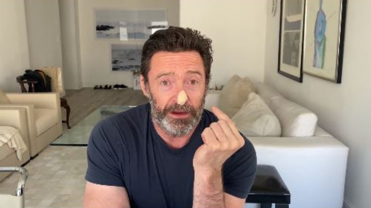 Hugh Jackman, ator de Wolverine, faz biópsias por suspeita de câncer de pele