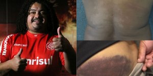 Ex-Inter e Corinthians é agredido por PM após jogo no Paraná