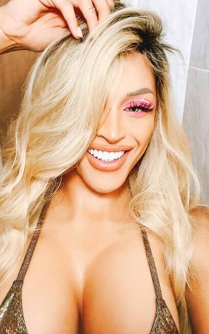 Pabllo VIttar surgiu com seis turbinados após colocar prótese temporária pabllo vittar