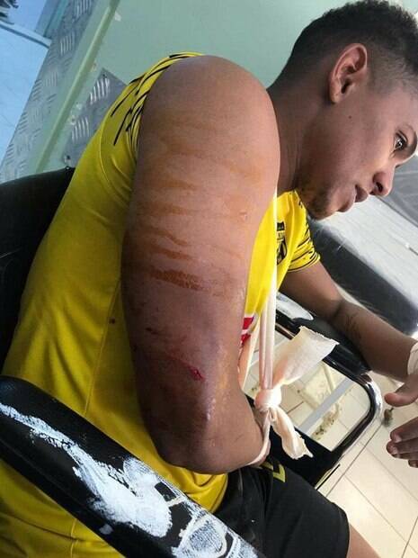 Gil Bahia%2C jogador brasileiro%2C levou uma pedrada durante partida na Tunísia Gil Bahia, jogador brasileiro, levou uma pedrada durante partida na Tunísia