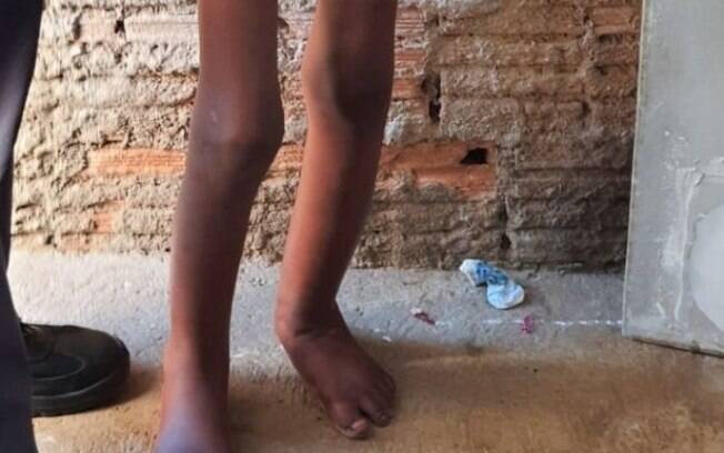 Casa da família de criança torturada é depredada por vizinhos