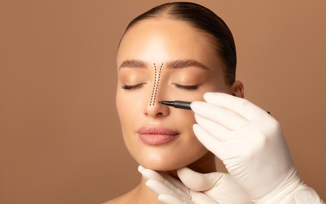 Rinoplastia associa correção estética e função respiratória
