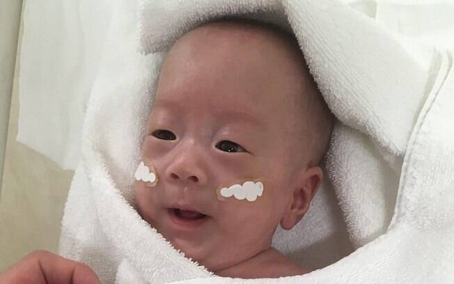Agora com 3,2 quilos, bebê recebeu alta do hospital em Tóquio