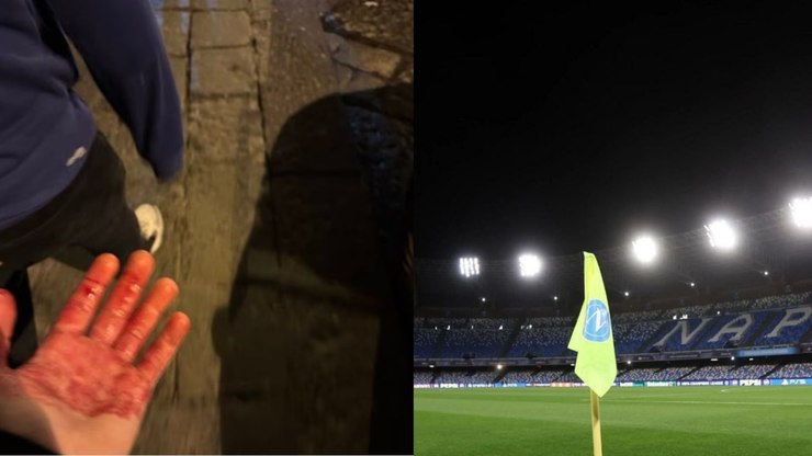 Torcedores do Chelsea sofrem emboscada antes de jogo da Champions