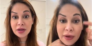 Maíra Cardi faz botox e fica torta: "Palhaçada"