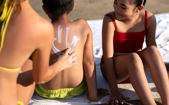 Protetor solar vencido é perigoso? Menino de 10 anos sofre queimaduras graves