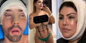 Espelho meu: busca pelo corpo perfeito entre os famosos é assustadora