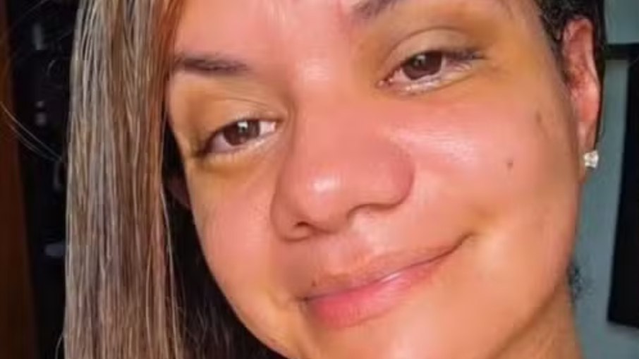 Mulher atacada em elevador revela necessidade de nova cirurgia