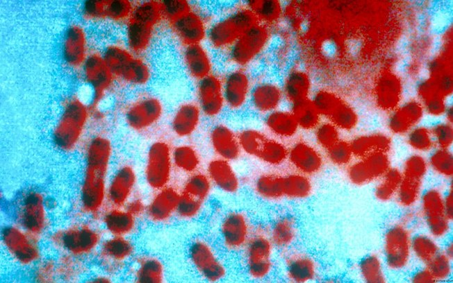 Yersinia pestis é causadora da peste pneumônica e da peste bubônica