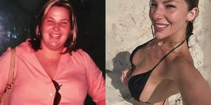 Repórter do "Mais Você" mostra antes e depois após perder 70 kg