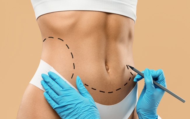 Cirurgia plástica busca naturalidade e equilíbrio