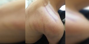 Menina de 8 anos apanha do pai por tomar "Toddynho" sem permissão