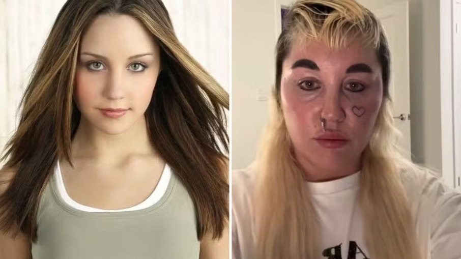 Ex-estrela teen reaparece nas redes e preocupa fãs com visual Ex-estrela teen reaparece nas redes e preocupa fãs com visual