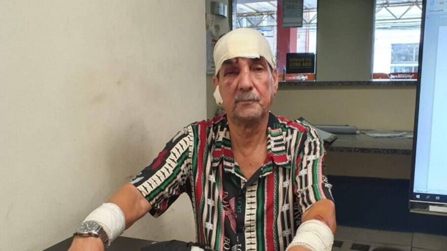 O motorista de ônibus Luiz Carlos Ribeiro teve ferimentos na cabeça e nos braços provocados por socos dados por Leonardo Costa Nogueira 