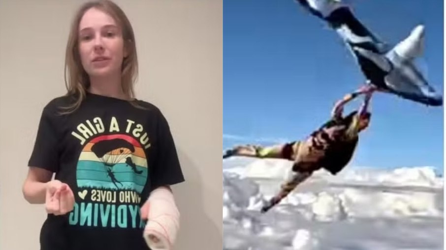 Mulher mostra momento em que quebrou a mão em salto Mulher mostra momento em que quebrou a mão em salto