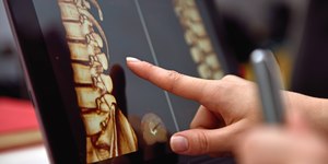 Medula óssea: entenda a importância da doação	