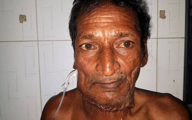 Somai foi operado no dia 12 de julho e segue em recuperação para, então, voltar para sua casa Somai foi operado no dia 12 de julho e segue em recuperação para, então, voltar para sua casa