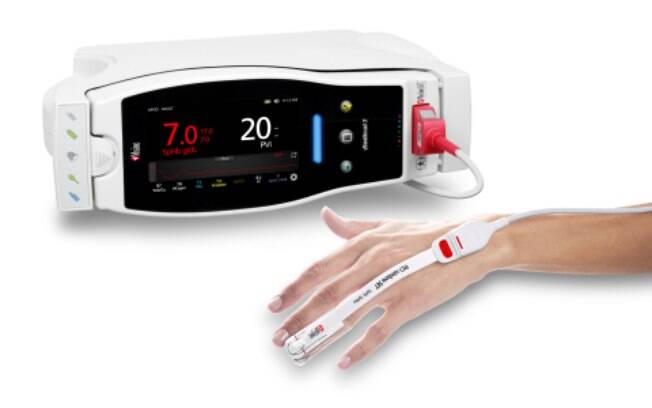 Estudo investiga efeitos do programa de gestão do sangue do paciente com o Masimo SpHb®, monitoramento de hemoglobina contínuo não invasivo, no pós operatório de pacientes com câncer