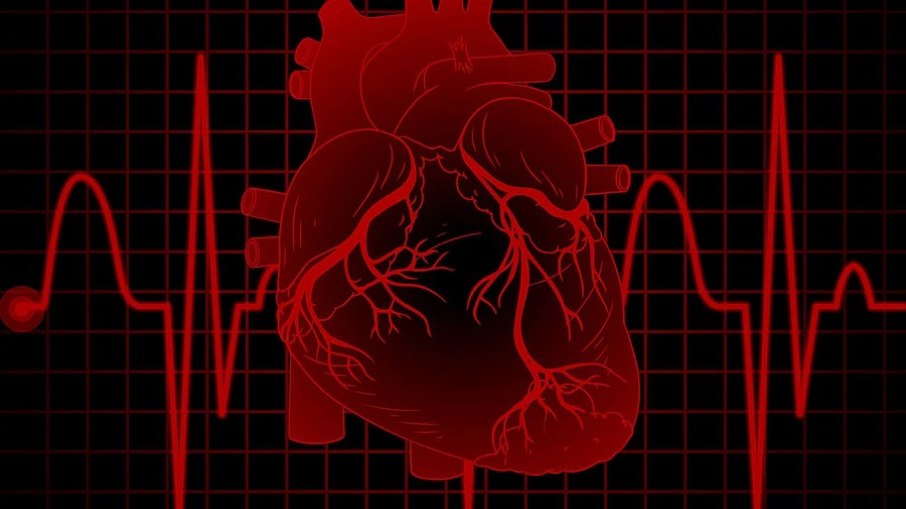 O enfraquecimento do músculo cardíaco impede do coração bombear sangue corretamente