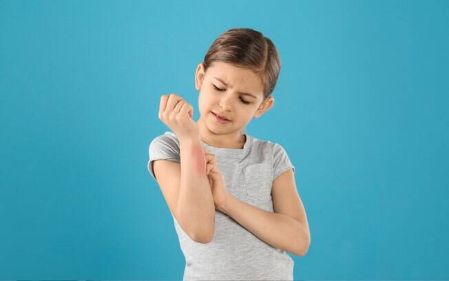 Saiba quais são as alergias mais comuns em crianças!