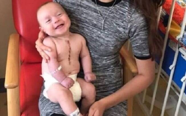 Foto do bebê sorridente viralizou na internet neste sábado; cirurgia cardíaca foi deixou cicatriz