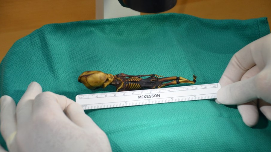 Pequeno humano