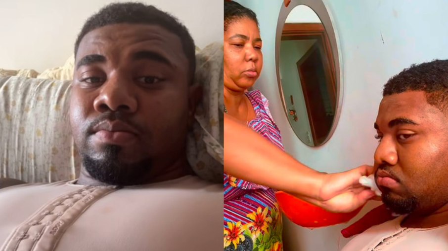 Davi Brito em recuperação após lipo HD