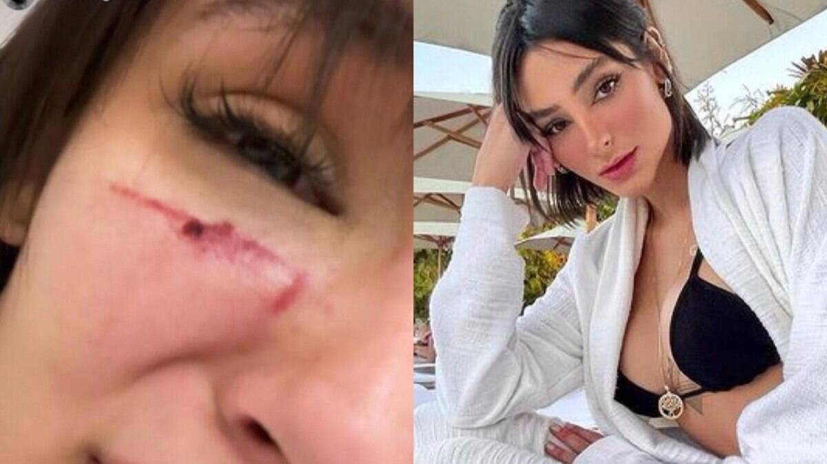 Modelo denuncia ex-namorado por agressão e recebe apoio de Neymar - Vimarsana News