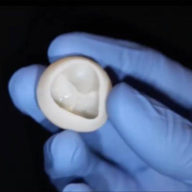 Cientistas americanos criam válvula de coração 3D feita de colágeno.