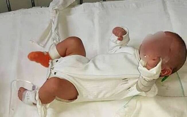 Mãe encontrou seu bebê com as pernas amarradas e fraldas sujas em um hospital na Croácia; enfermeira foi a responsável