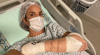 Ivete Sangalo passa por cirurgia no braço após lesão em esqui 