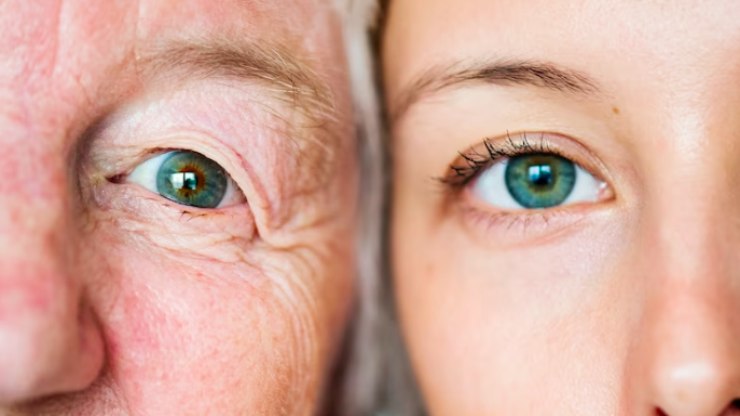 Entenda como a menopausa pode comprometer a saúde dos olhos