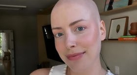Em tratamento, Fabiana Justus desabafa sobre uso de peruca