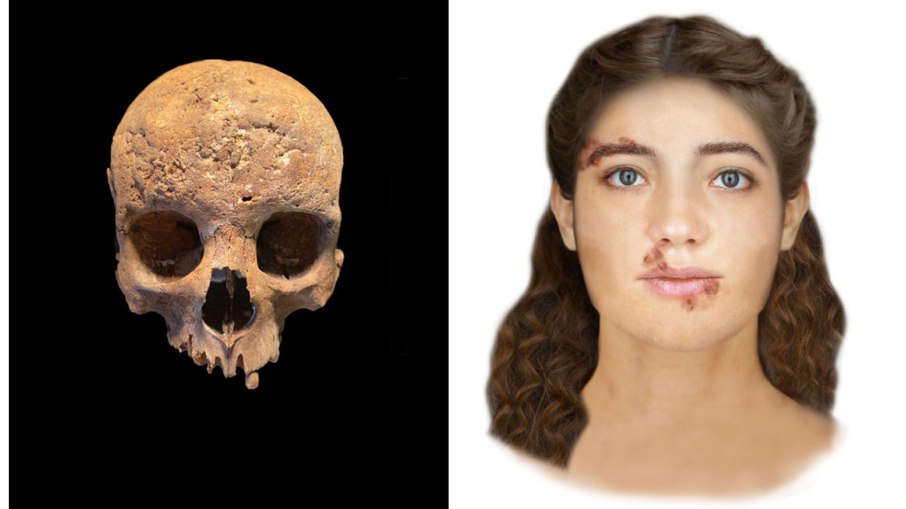 O crânio de uma mulher apresenta marcas deixadas pela sífilis, à esquerda; cientistas forenses reconstruíram como sua aparência seria em vida, à direita.