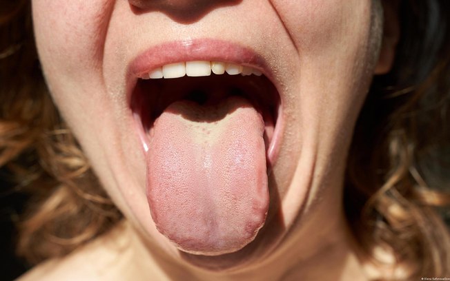 Resposta sobre a existência de um câncer silencioso pode estar na saliva, segundo pesquisa Resposta sobre a existência de um câncer silencioso pode estar na saliva, segundo pesquisa