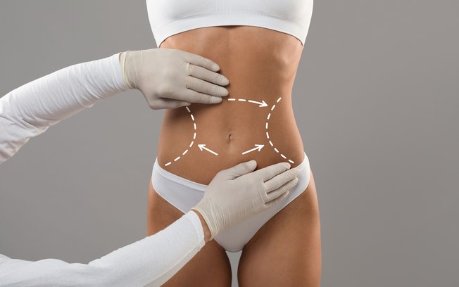 Cirurgia plástica avança com técnicas mais personalizadas