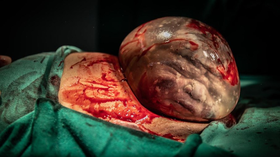 Nicolas, primeiro bebê empelicado fotografado por Ludmila Gusman.