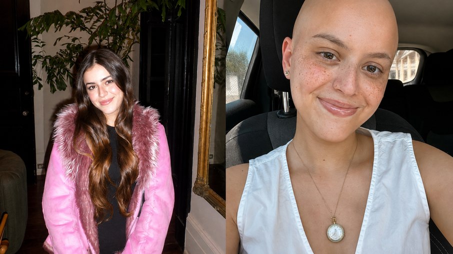 Lilly Dalton faleceu em janeiro de 2026, aos 23 anos, após lutar contra o Tumor Desmoplásico de Pequenas Células Redondas (DSRCT) Lilly Dalton faleceu em janeiro de 2026, aos 23 anos, após lutar contra o Tumor Desmoplásico de Pequenas Células Redondas (DSRCT)