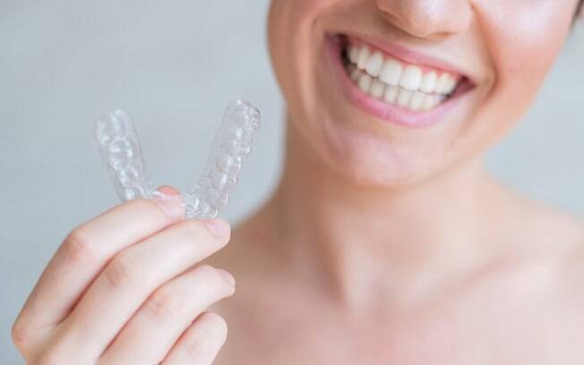 Alinhadores transparentes: saiba mitos e verdades sobre o método odontológico