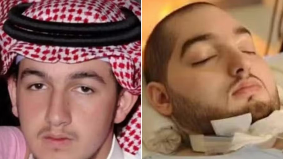 O príncipe saudita Al-Waleed bin Khaled bin Talal Al Saud antes e após o acidente que o deixou em coma por 20 anos O príncipe saudita Al-Waleed bin Khaled bin Talal Al Saud antes e após o acidente que o deixou em coma por 20 anos