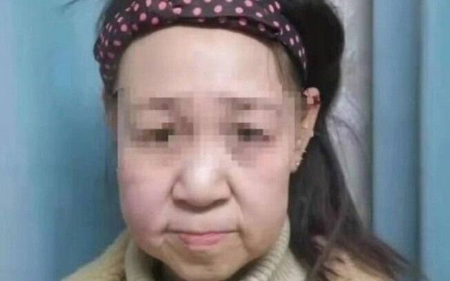 Xiao Feng, de 15 anos, tem uma doença rara que a faz aparentar ser bem mais velha que a sua idade real