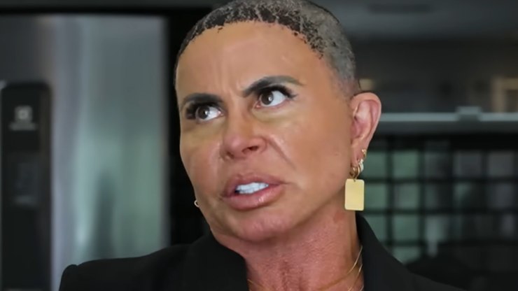 Gretchen%20sobre%20transplante%20capilar%3A%20%22Recebendo%20o%20apoio%22