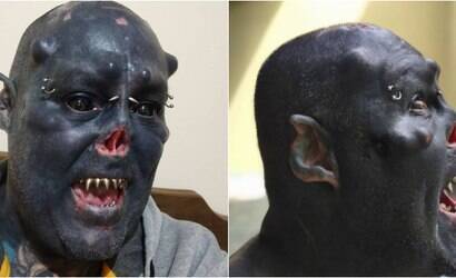 Homem mutila nariz e modifica corpo para parecer caveira