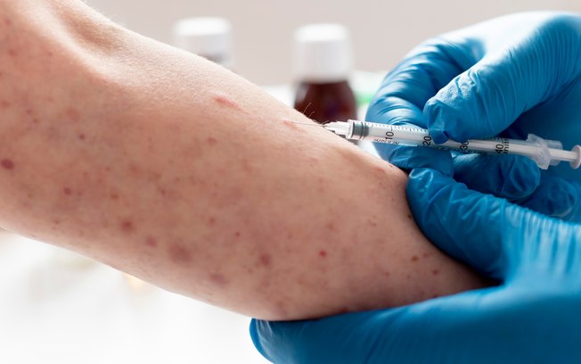 Nova variante da mpox é mais letal, diz infectologista
