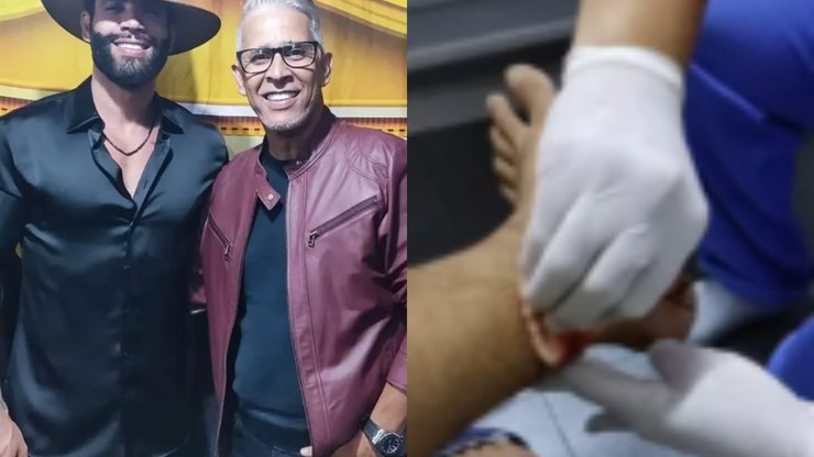 Irmão de Gusttavo Lima é atacado por macacos em Goiânia