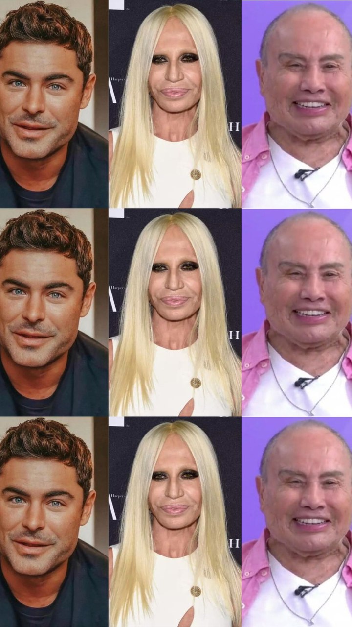 Donatella Versace antes e depois da cirurgia: foto 