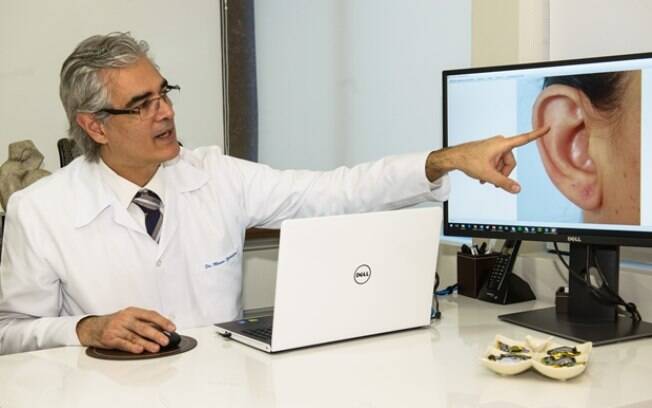 Mdico brasileiro desenvolve tcnica que leva a otoplastia a uma nova era