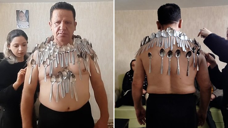 Iraniano%20quebra%20recorde%20ao%20grudar%2096%20colheres%20no%20corpo