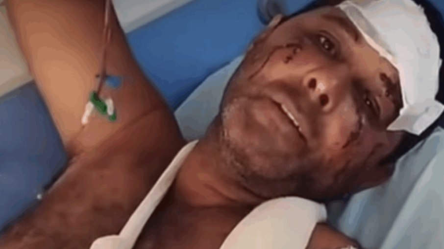 Homem é atacado por onça-pintada em Goiás